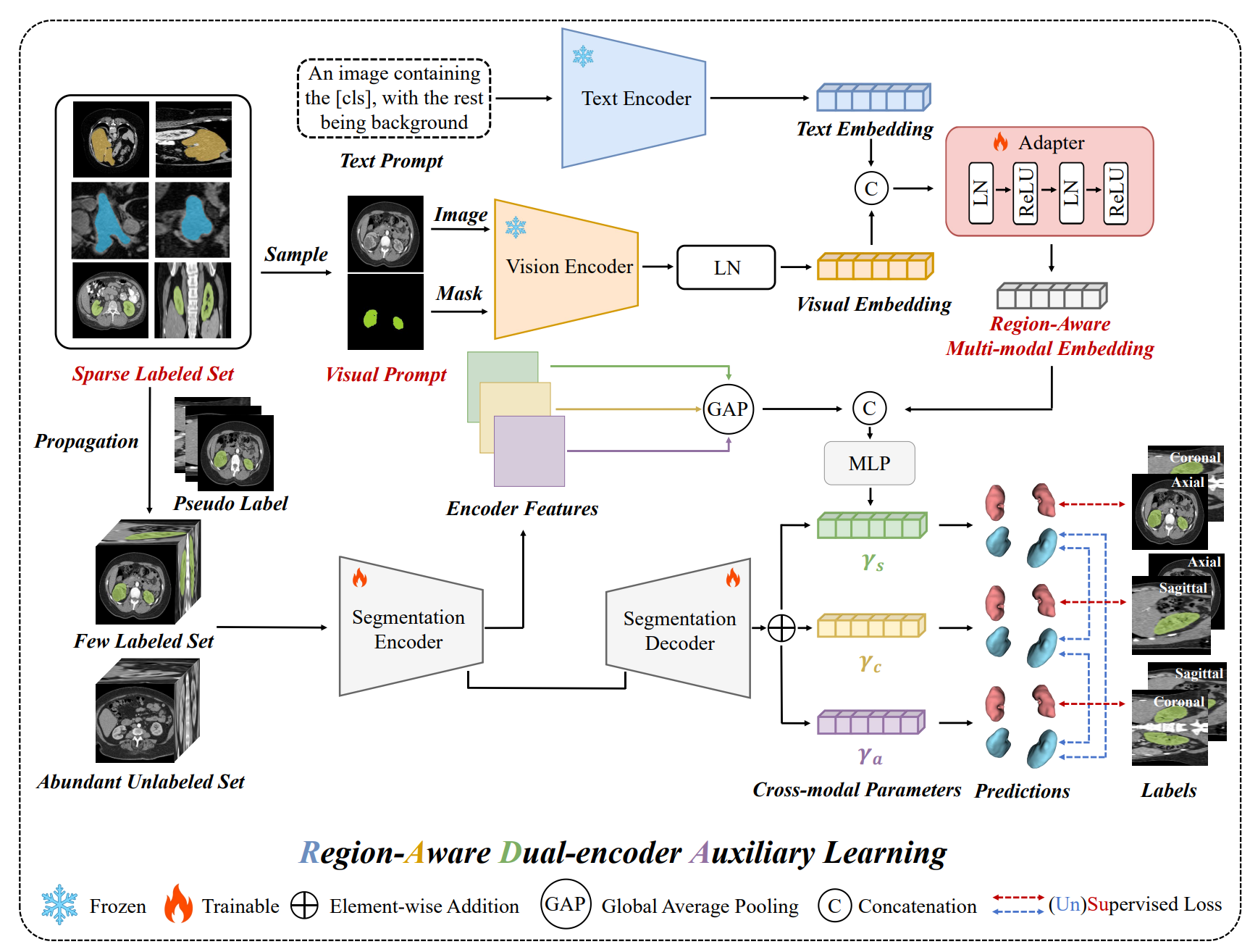 RADA: Region-Aware Dual-encoder Auxiliary Learning for Barely-supervised Medical Image Segmentation